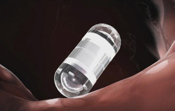 الكاميرا الكبسولة تقنية حديثة لاكتشاف أمراض الهضم