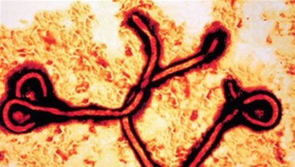 علاج تجريبي لفيروس "إيبولا"