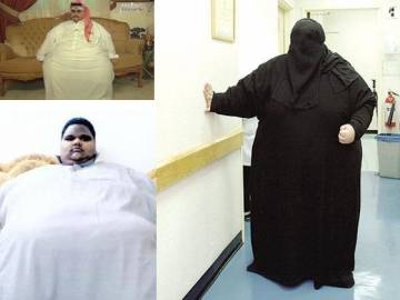 الكويت الأولى عربياً في السمنة